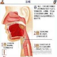 邯郸武安食道癌治疗-哪里有可信赖的武安食道癌治疗