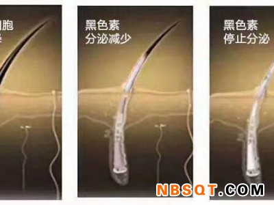 白发转黑-有口皆碑的慧丝莱头营养液护养套装推荐图1