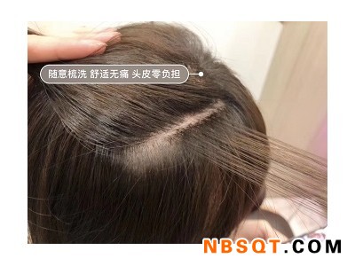中山织发价格|专业的织发机构图1